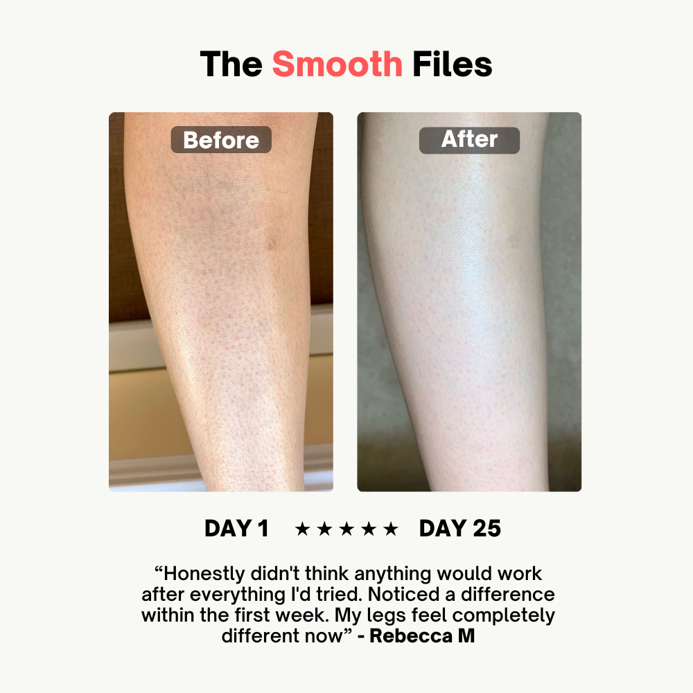 Smooth Away Keratosis Pilaris Cream